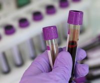 Spitalul de Pneumoftiziologie Scornicesti